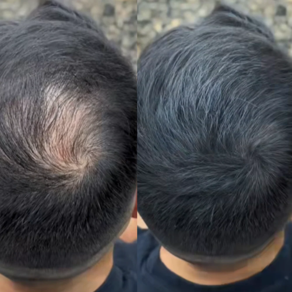 HairThick - Ger fylligt hår på sekunder!